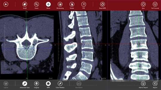 Navegatium DICOM Viewer screenshot 5