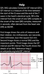 QTc EKG screenshot 7